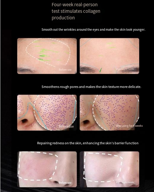 IPL Photon Skin Rejuvenation Beauty Mask